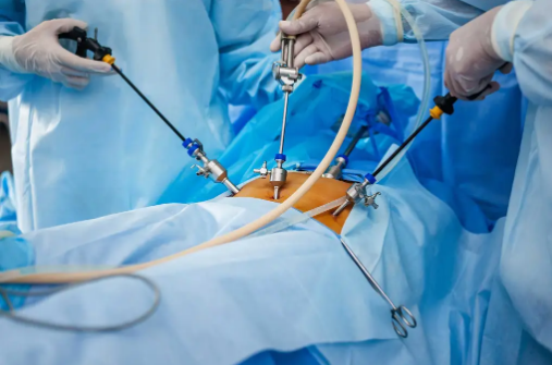 Laproscopic Surgery | PanOrtho Hospital