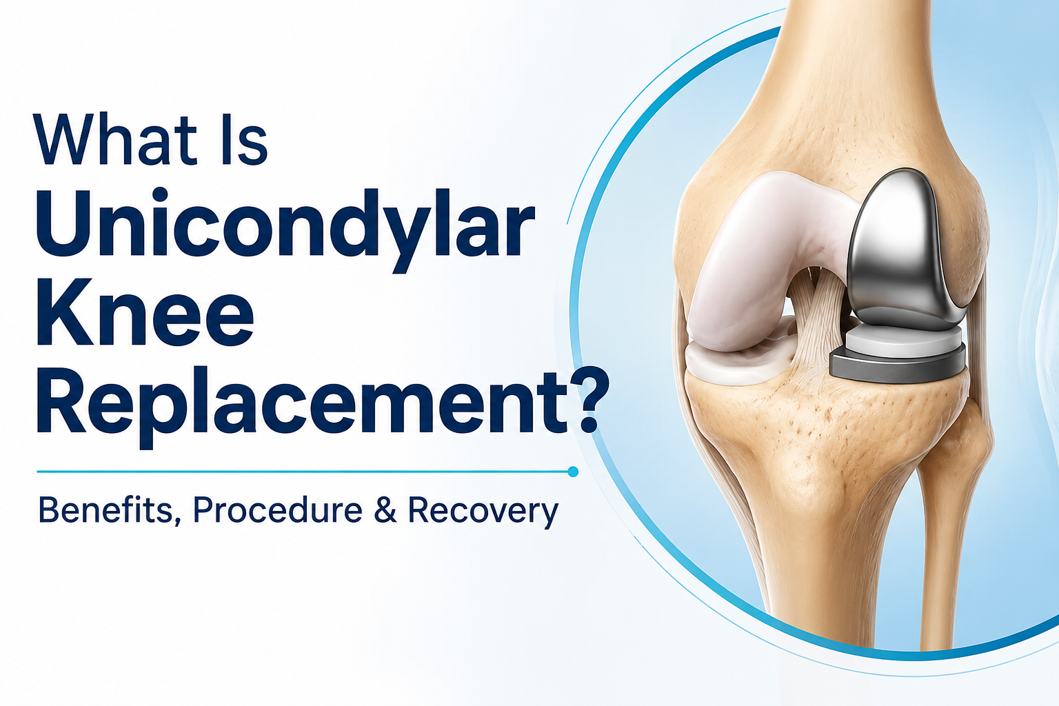 unicondylar knee replacement PCMC